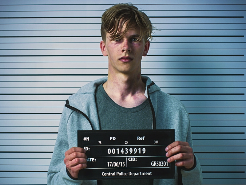 Accused of Sharing Intimate Images Without Consent in Minnesota? What to Know 1 A young man with bruises posing for a mugshot. Accused of Sharing Intimate Images